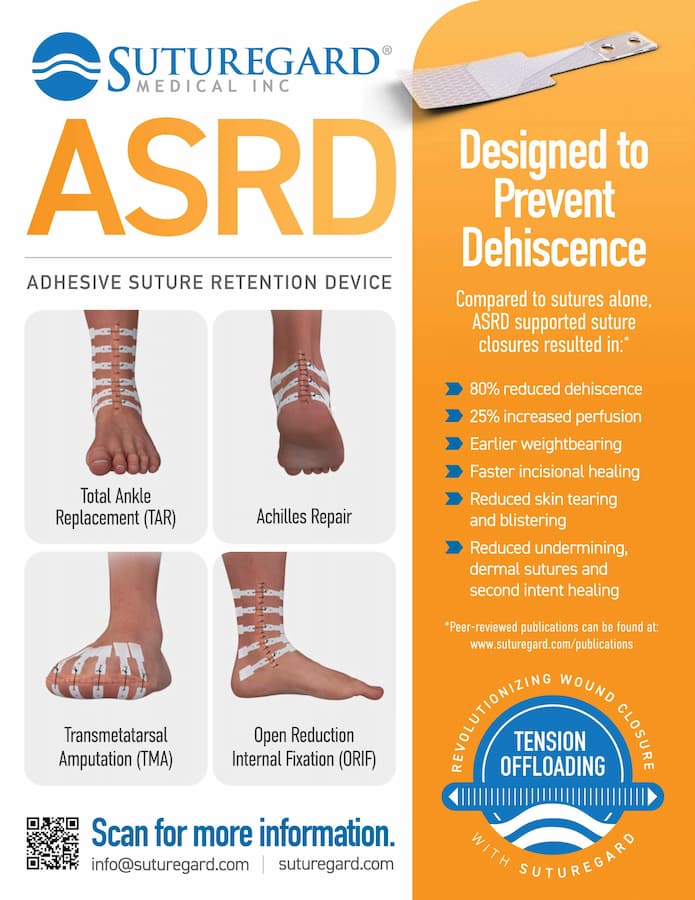 ASRD Foot Ankle